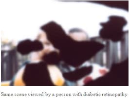 example of persons' vision with diabetic retinopathy